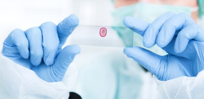 تعرفه آزمایشگاه